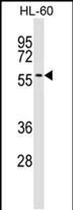 IFRD2 Antibody in Western Blot (WB)
