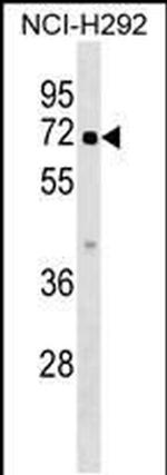 ZBTB44 Antibody in Western Blot (WB)