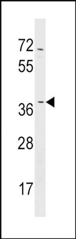 NMNAT2 Antibody in Western Blot (WB)