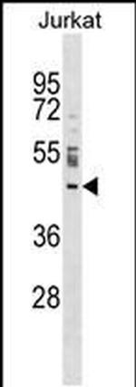 NUP43 Antibody in Western Blot (WB)