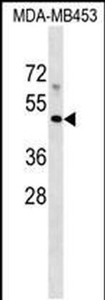 MR1 Antibody in Western Blot (WB)