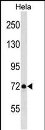 LAS1L Antibody in Western Blot (WB)