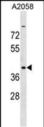 ADAT3 Antibody in Western Blot (WB)