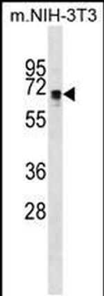 NR1 Antibody in Western Blot (WB)