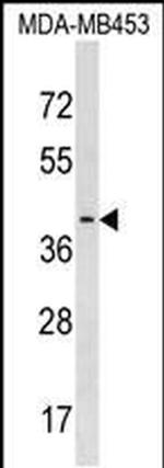 PAFAH2 Antibody in Western Blot (WB)