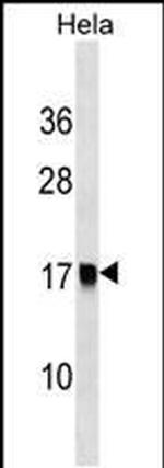 AP2S1 Antibody in Western Blot (WB)