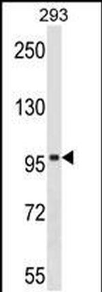 SPIRE1 Antibody in Western Blot (WB)