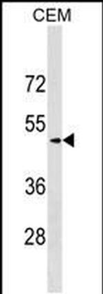 SCG3 Antibody in Western Blot (WB)