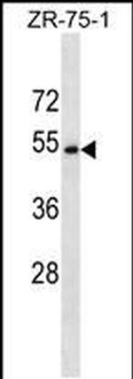 CCDC112 Antibody in Western Blot (WB)