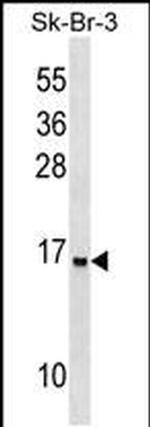 UTS2B Antibody in Western Blot (WB)