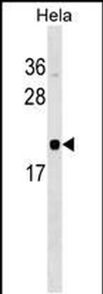 Rwdd1 Antibody in Western Blot (WB)