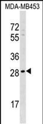 AIDA Antibody in Western Blot (WB)