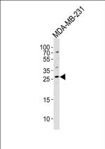 CRISP1 Antibody in Western Blot (WB)