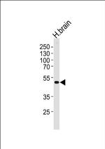 Kir2.2 (KCNJ12) Antibody in Western Blot (WB)