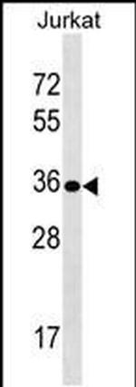UPK3B Antibody in Western Blot (WB)