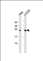 DCTN6 Antibody in Western Blot (WB)
