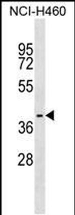 WBP2NL Antibody in Western Blot (WB)