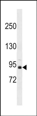 ZBTB49 Antibody in Western Blot (WB)