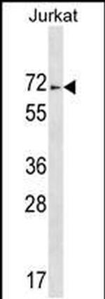 ZNF613 Antibody in Western Blot (WB)