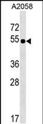 NHEDC2 Antibody in Western Blot (WB)