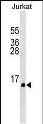PATE1 Antibody in Western Blot (WB)