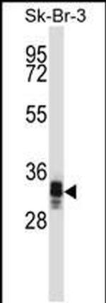 UBXN10 Antibody in Western Blot (WB)