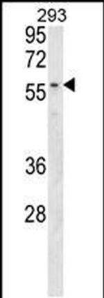 MBOAT2 Antibody in Western Blot (WB)