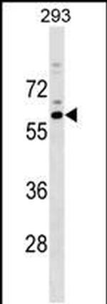 RASGEF1C Antibody in Western Blot (WB)