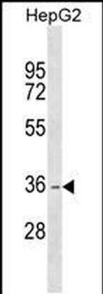 DHRS1 Antibody in Western Blot (WB)