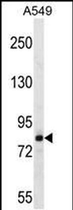 FSCB Antibody in Western Blot (WB)