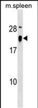 ALG13 Antibody in Western Blot (WB)