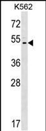 ASIC5 Antibody in Western Blot (WB)