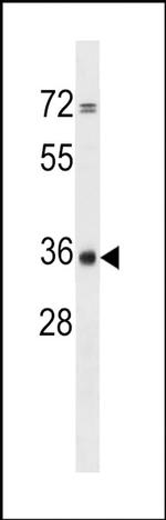 CPPED1 Antibody in Western Blot (WB)