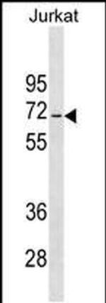 JRKL Antibody in Western Blot (WB)