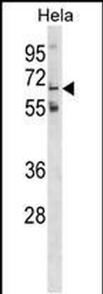 GALNT11 Antibody in Western Blot (WB)