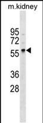 GALNT11 Antibody in Western Blot (WB)