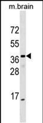 ELMOD1 Antibody in Western Blot (WB)
