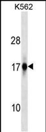 ZFAND2A Antibody in Western Blot (WB)