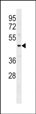 ONECUT3 Antibody in Western Blot (WB)