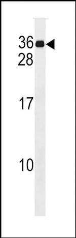MND1 Antibody in Western Blot (WB)