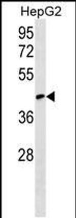 RCSD1 Antibody in Western Blot (WB)