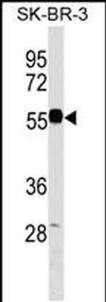 EEPD1 Antibody in Western Blot (WB)