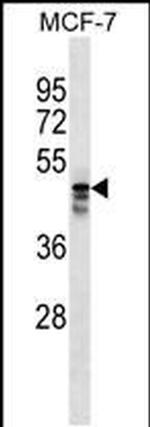 AP5M1 Antibody in Western Blot (WB)