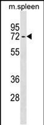 ENTPD4 Antibody in Western Blot (WB)