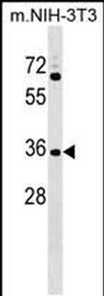 GPATCH11 Antibody in Western Blot (WB)