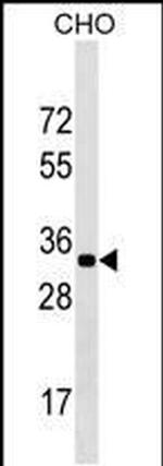 GPATCH11 Antibody in Western Blot (WB)
