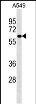 PIGS Antibody in Western Blot (WB)