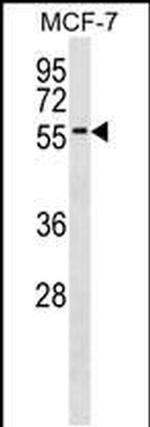 ZNF787 Antibody in Western Blot (WB)