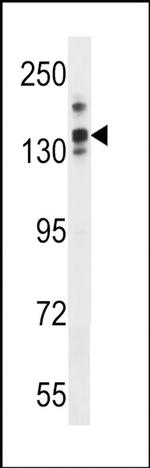 LRRC16A Antibody in Western Blot (WB)