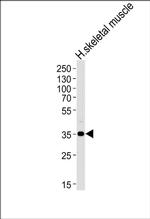 PPP1R3B Antibody in Western Blot (WB)